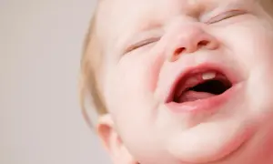 Ein Baby weint, weil es zahnt. Ein kleiner Zahn bricht durch das Zahnfleisch.