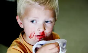 Junge mit blutiger Nase und einem Tuch. Ein häufiges Problem bei Kindern ist nasenbluten.