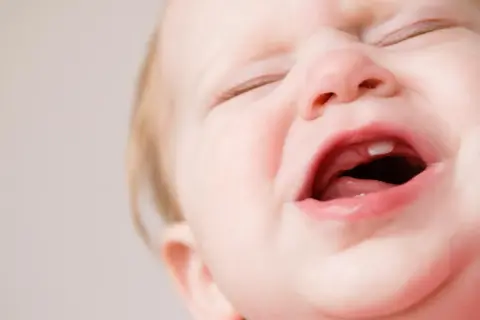 Ein Baby weint, weil es zahnt. Ein kleiner Zahn bricht durch das Zahnfleisch.