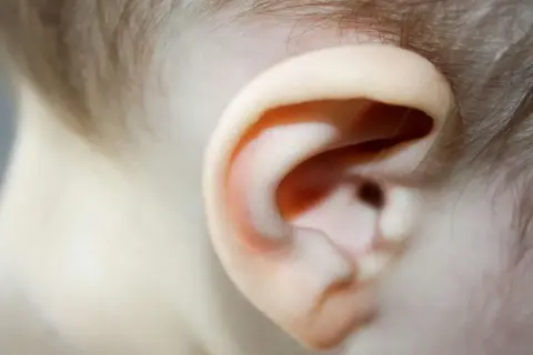 Nahaufnahme eines Kinderohrs. Bei Ohrenschmerzen können Hausmittel Linderung verschaffen.