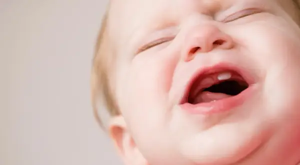 Ein Baby weint, weil es zahnt. Ein kleiner Zahn bricht durch das Zahnfleisch.