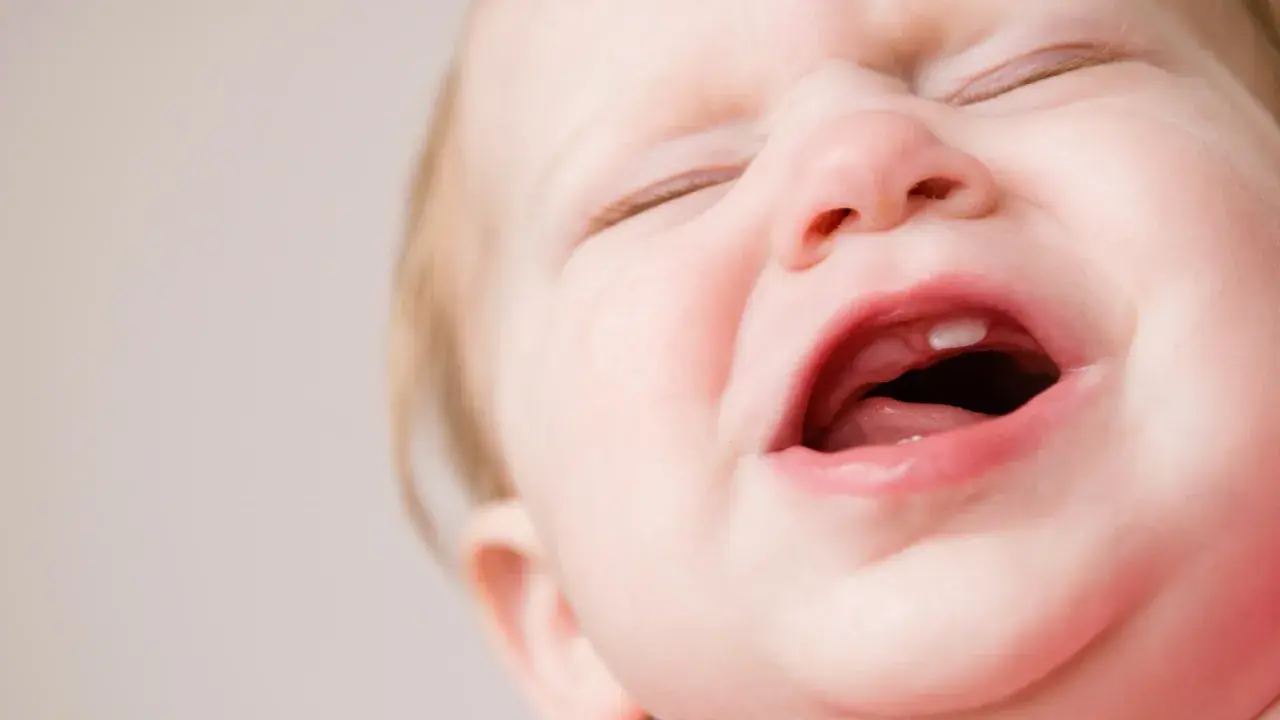 Ein Baby weint, weil es zahnt. Ein kleiner Zahn bricht durch das Zahnfleisch.